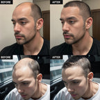 "Adglamful Hair Fiber Kit 15g Unisex Adds Volume Conceals Thinning Fills Hairline