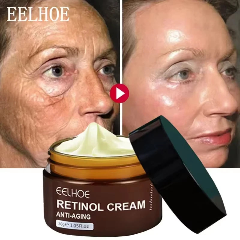 Retinol Wrinkle Remover Face Cream Firming Lifting Anti Aging Fade Fine Lines Moisturizing Whitening Korean
