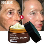 Retinol Wrinkle Remover Face Cream Firming Lifting Anti Aging Fade Fine Lines Moisturizing Whitening Korean
