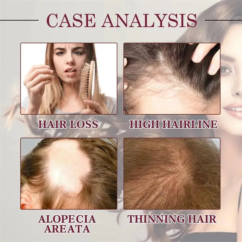 Fast Hair Growth Serum Men