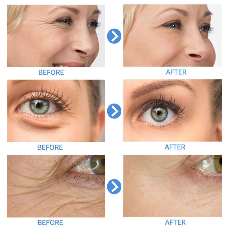 Retinol Wrinkle Remover Face Cream Firming Lifting Anti Aging Fade Fine Lines Moisturizing Whitening Korean