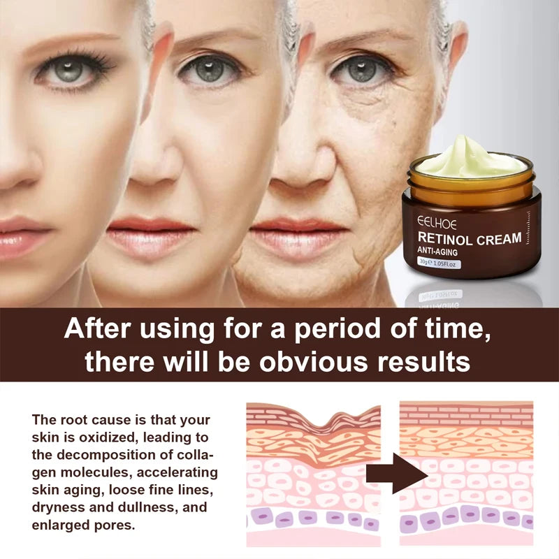 Retinol Wrinkle Remover Face Cream Firming Lifting Anti Aging Fade Fine Lines Moisturizing Whitening Korean