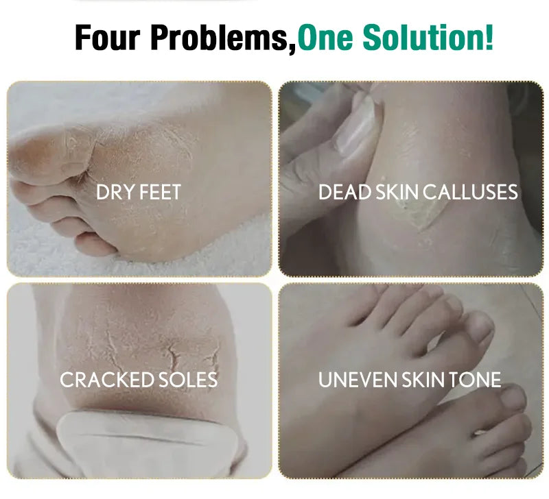 Aloe Foot Peel Mask For Dry Rough Cracked Feet