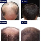 7 Day Fast Hair Growth Serum