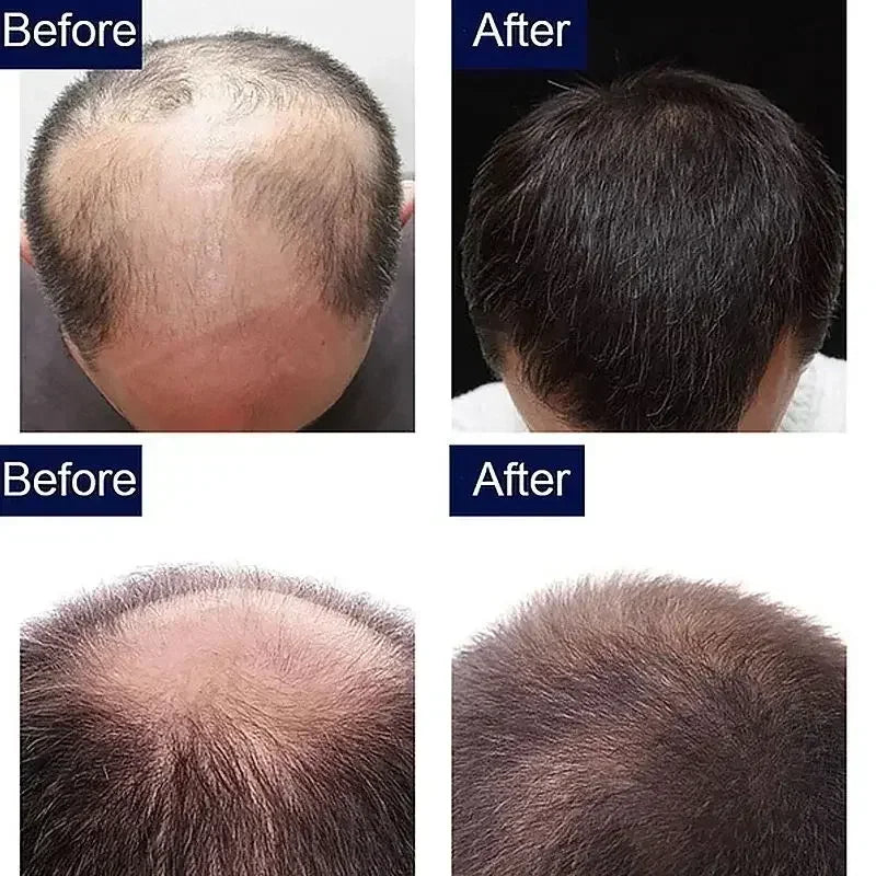 7 Day Fast Hair Growth Serum