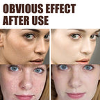 Retinol Wrinkle Remover Face Cream Firming Lifting Anti Aging Fade Fine Lines Moisturizing Whitening Korean