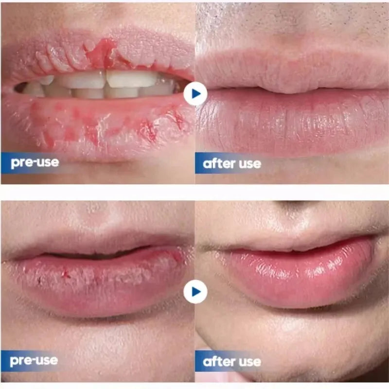 Men's  Lip Balm Moisturizing Hydration Fading Lip Lines Anti-Cracking Remove Dead Skin Refreshing Not Greasy