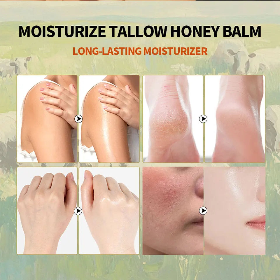 100g/3.5 0z. Moisturizer Tallow Honey Balm  Manuka Body Lotion Lip Balm