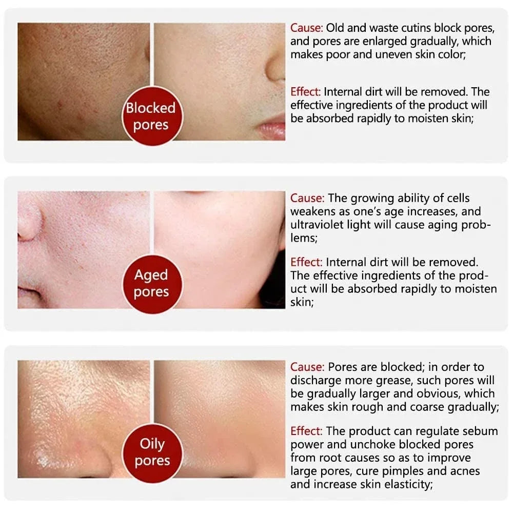 Skin Texture Pore Refining Resurfacing Brightening Facial Serum Retinol and Niacinamide Non-Comedogenic