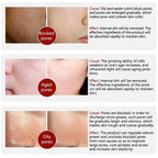 Skin Texture Pore Refining Resurfacing Brightening Facial Serum Retinol and Niacinamide Non-Comedogenic