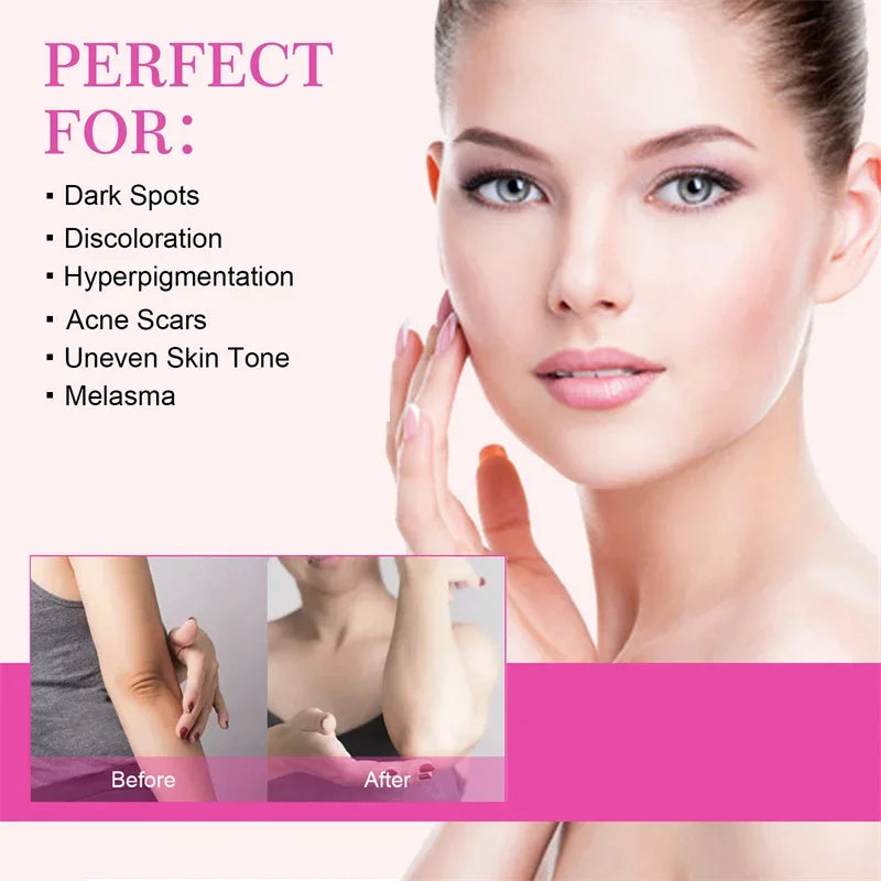 Brightening Cream For Body Knees Remove Dull Pigments Elbows Knuckles Lightening