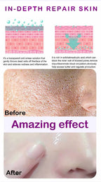Skin Texture Pore Refining Resurfacing Brightening Facial Serum Retinol and Niacinamide Non-Comedogenic