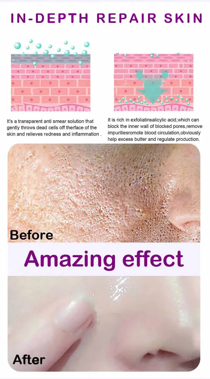 Skin Texture Pore Refining Resurfacing Brightening Facial Serum Retinol and Niacinamide Non-Comedogenic