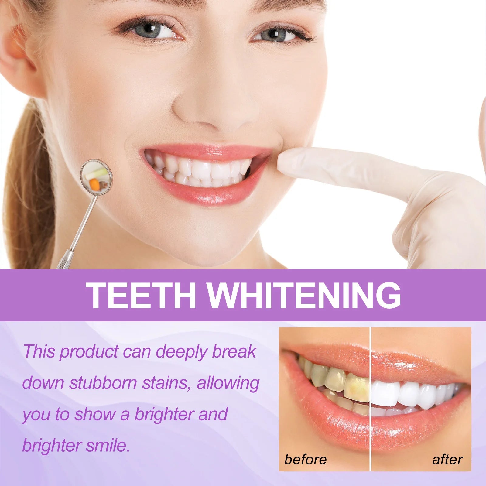 Purple Whitening Teeth Stickers 14 Pairs