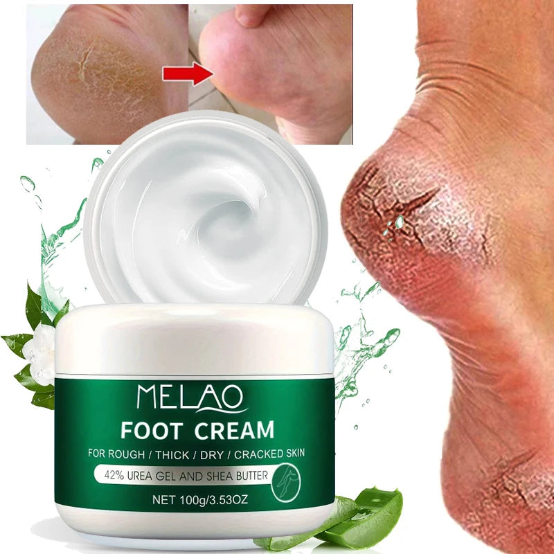MELAO Urea Cream Salicylic Acid Dry Cracked Feet Heels Dead Skin Remover