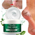 MELAO Urea Cream Salicylic Acid Dry Cracked Feet Heels Dead Skin Remover