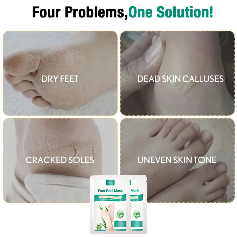 Aloe Foot Peel Mask For Dry Rough Cracked Feet