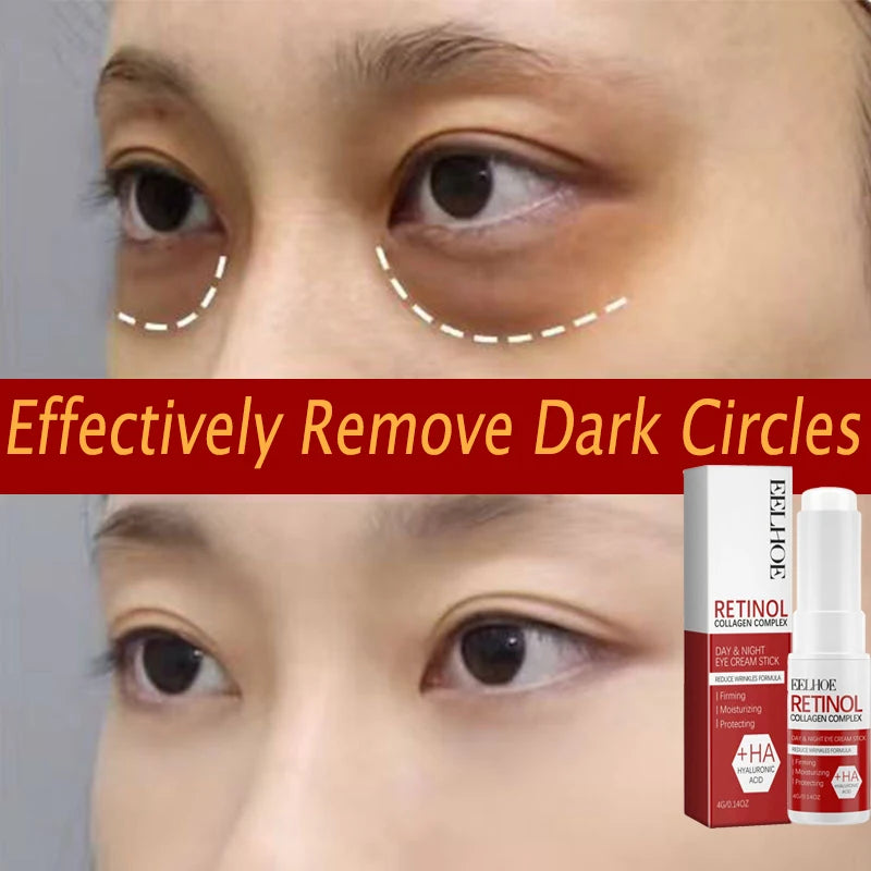 Retinol Eye Cream Collagen Stick Hyaluronic Acid