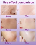 Skin Texture Pore Refining Resurfacing Brightening Facial Serum Retinol and Niacinamide Non-Comedogenic