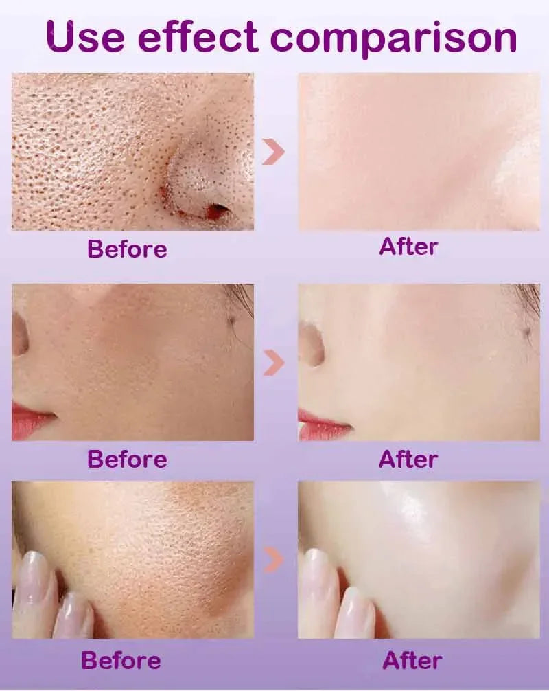 Skin Texture Pore Refining Resurfacing Brightening Facial Serum Retinol and Niacinamide Non-Comedogenic