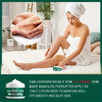 MELAO Urea Cream Salicylic Acid Dry Cracked Feet Heels Dead Skin Remover