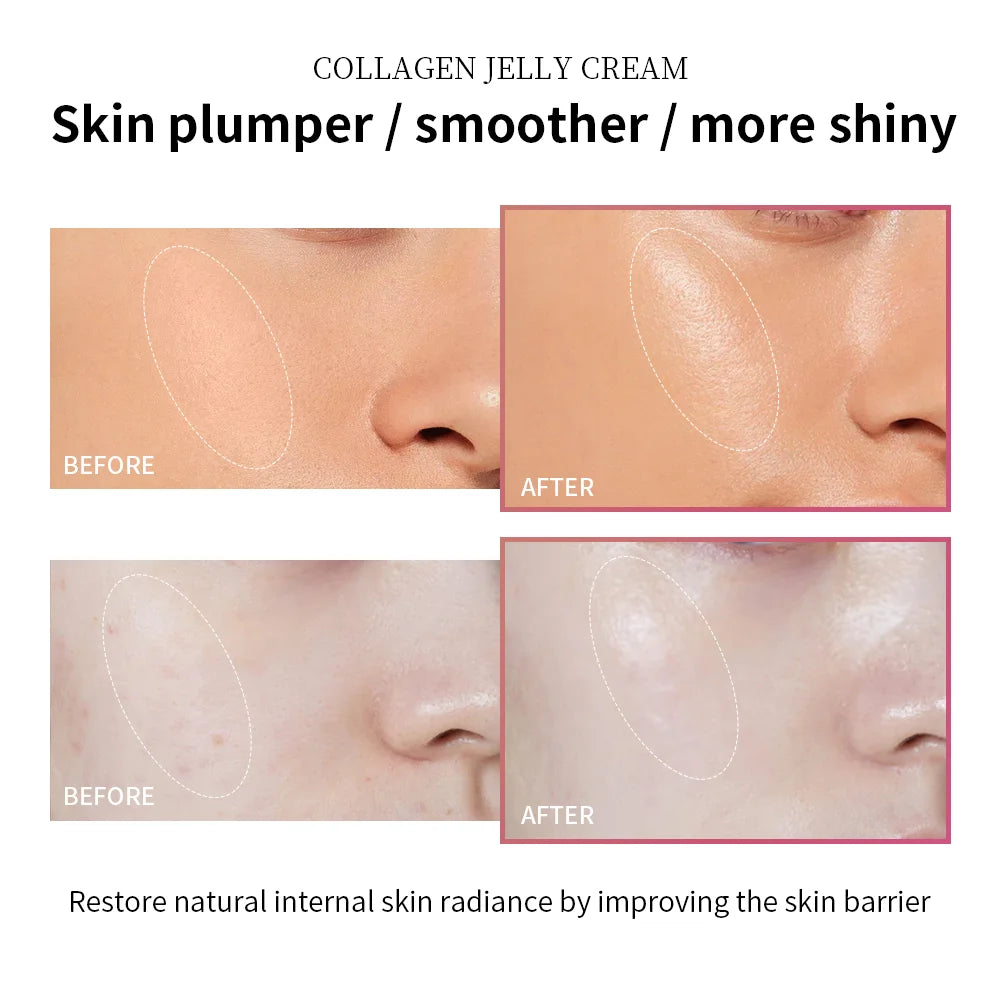 Moisturizing Jelly Cream Niacinamide Hydrolyzed Collagen Tightening Soothing Anti-Aging Firmness Hydration Skincare