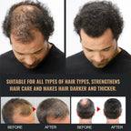Anti Baldness Shampoo Thickening Root Activator Nourish Regrowth for Thinning Hair & Hair Loss