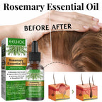 Rosemary Essential Oil Hair Growth 30ML Nourish Shiny Healthy
