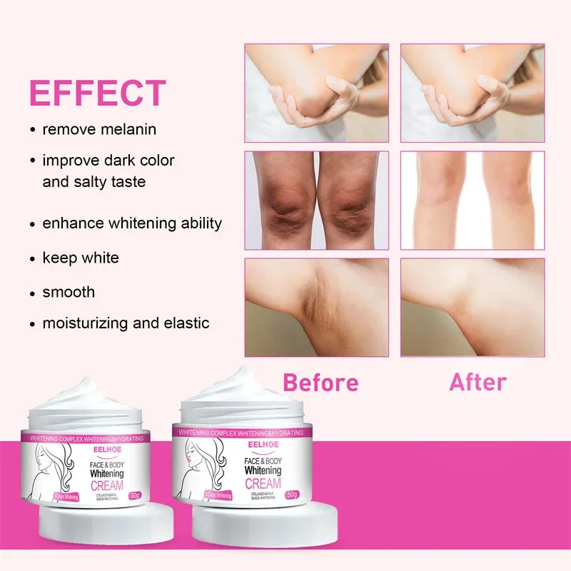 Brightening Cream For Body Knees Remove Dull Pigments Elbows Knuckles Lightening