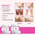 Brightening Cream For Body Knees Remove Dull Pigments Elbows Knuckles Lightening