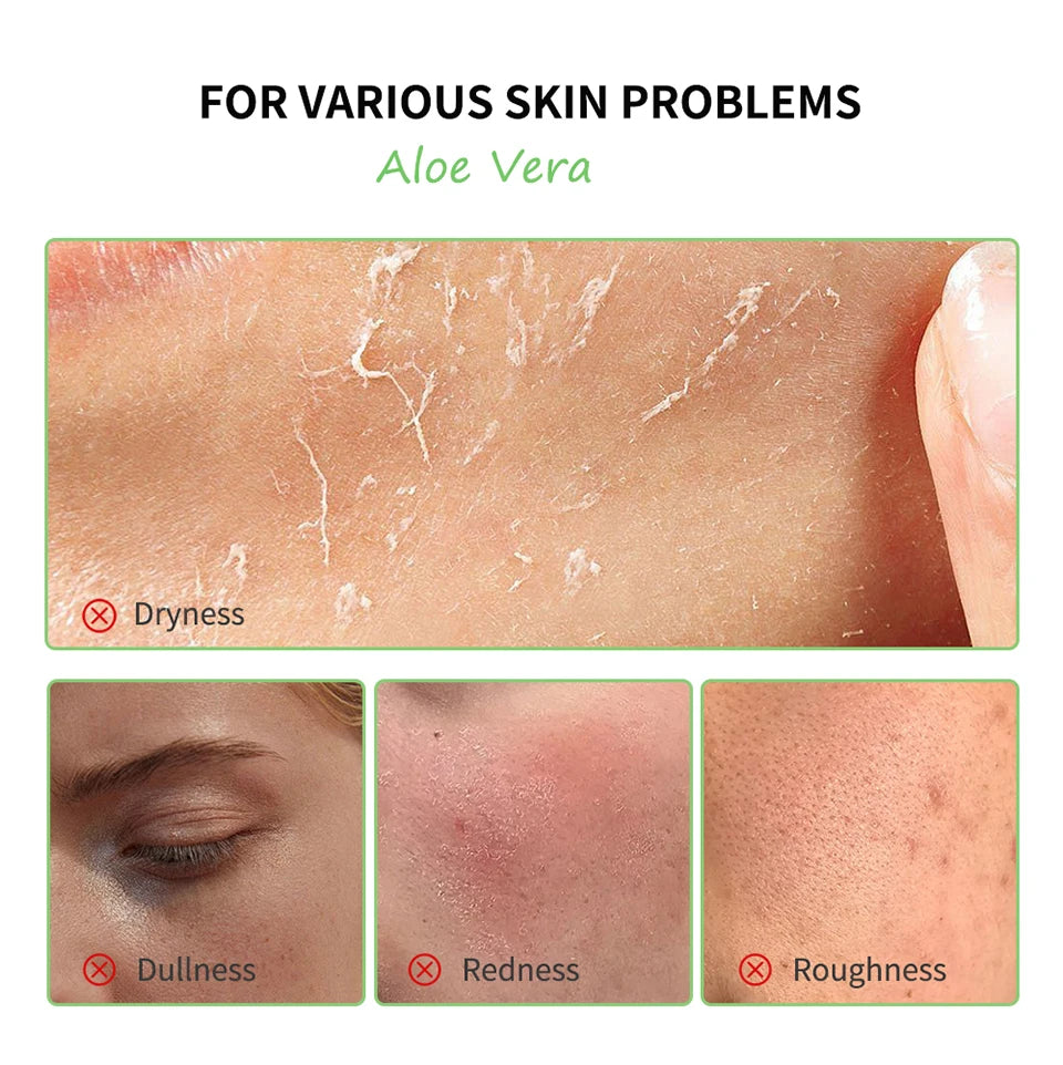 Multi-skin Care Aloe Vera Set Deep Moisturizing Nourishment Whitening Brightening Hydrating
