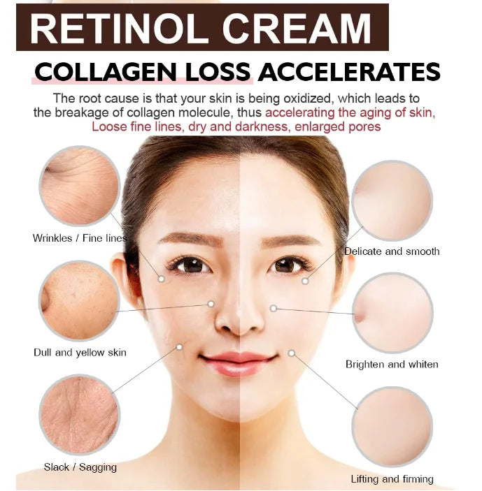 Retinol Wrinkle Remover Face Cream Firming Lifting Anti Aging Fade Fine Lines Moisturizing Whitening Korean