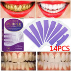 Purple Whitening Teeth Stickers 14 Pairs