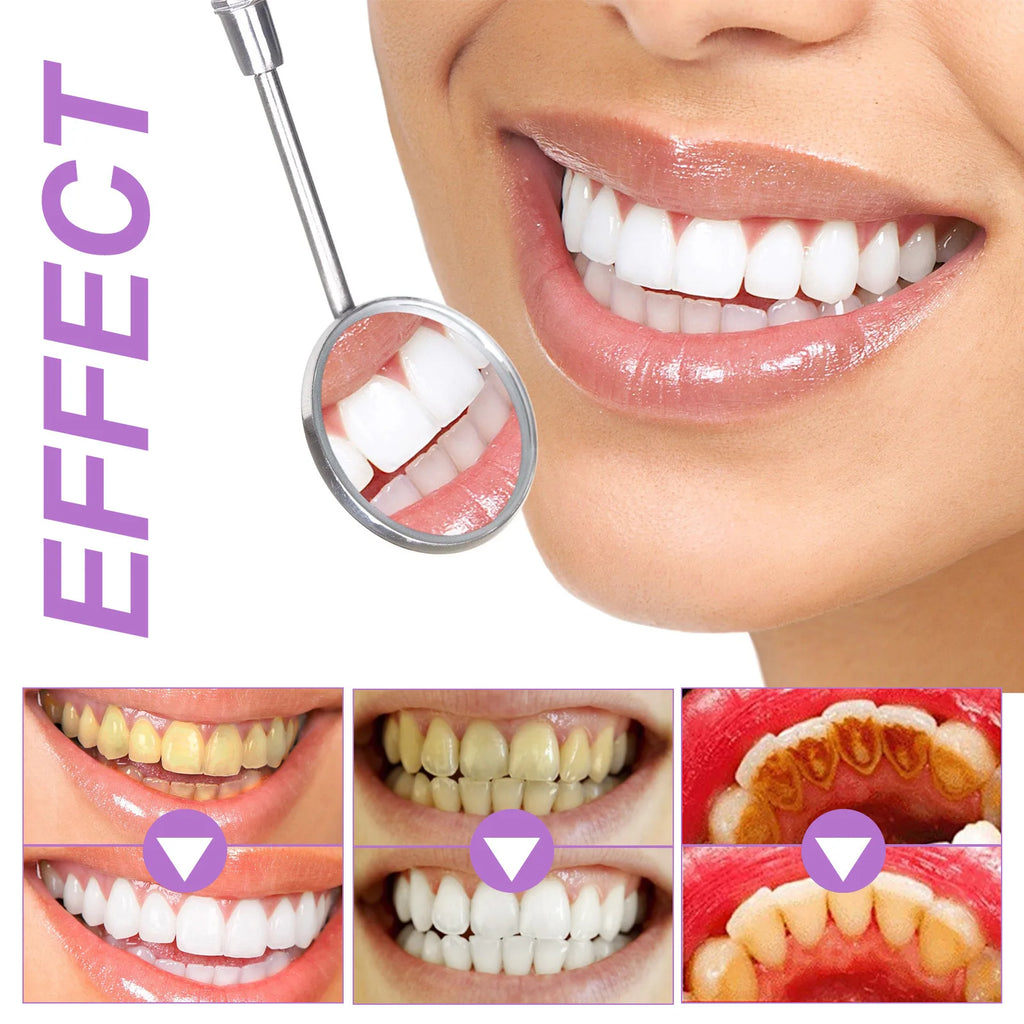 Purple Whitening Teeth Stickers 14 Pairs