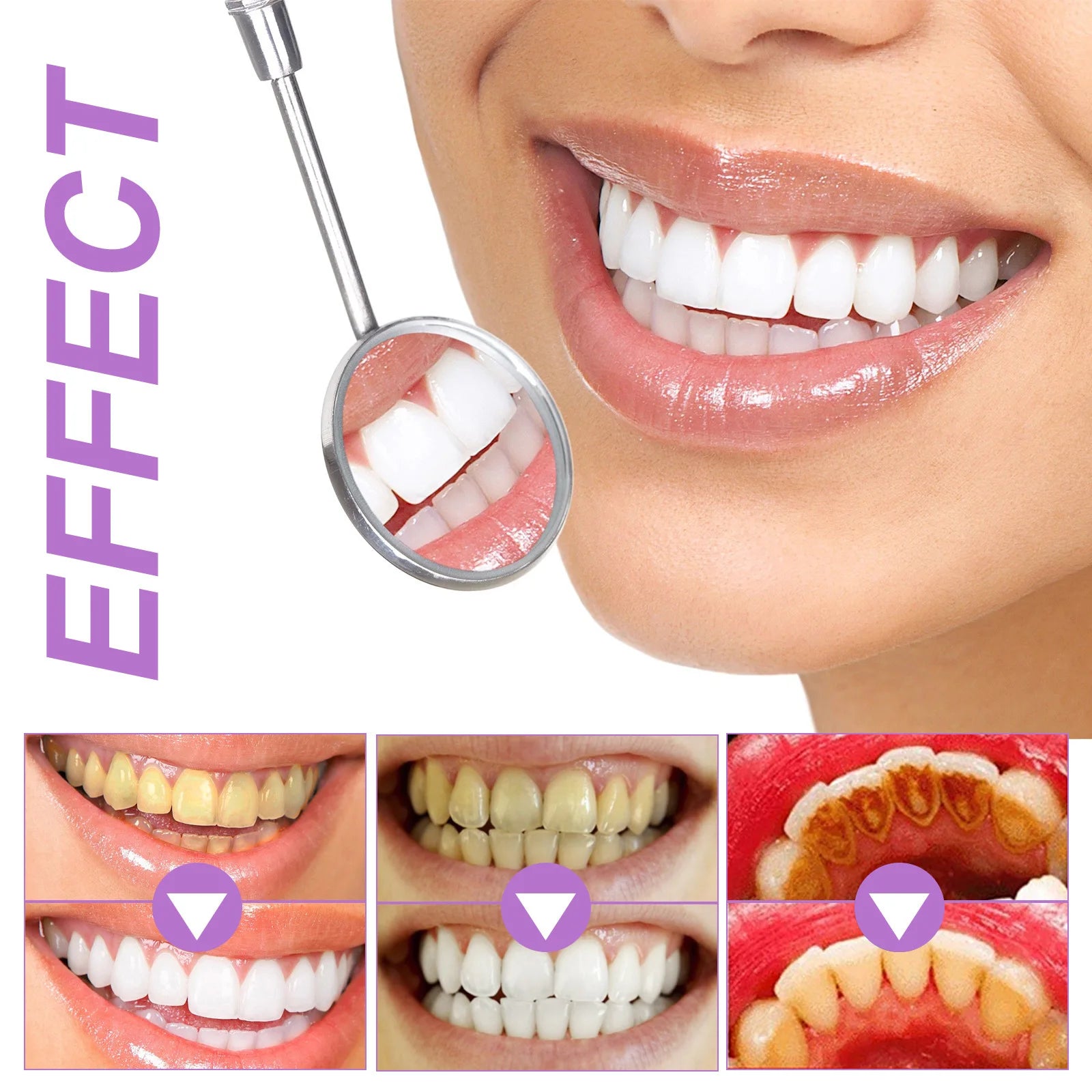 Purple Whitening Teeth Stickers 14 Pairs