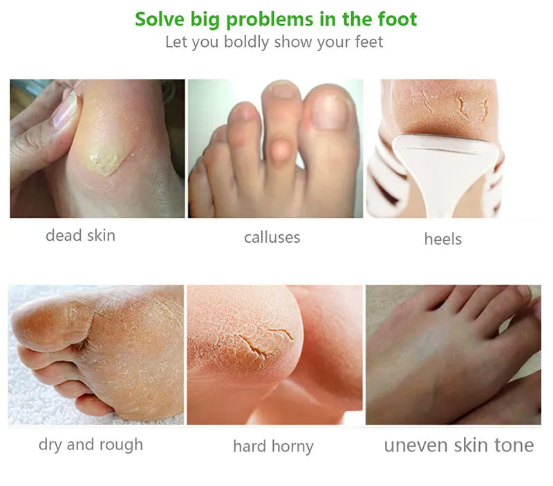 Exfoliating Foot Masks