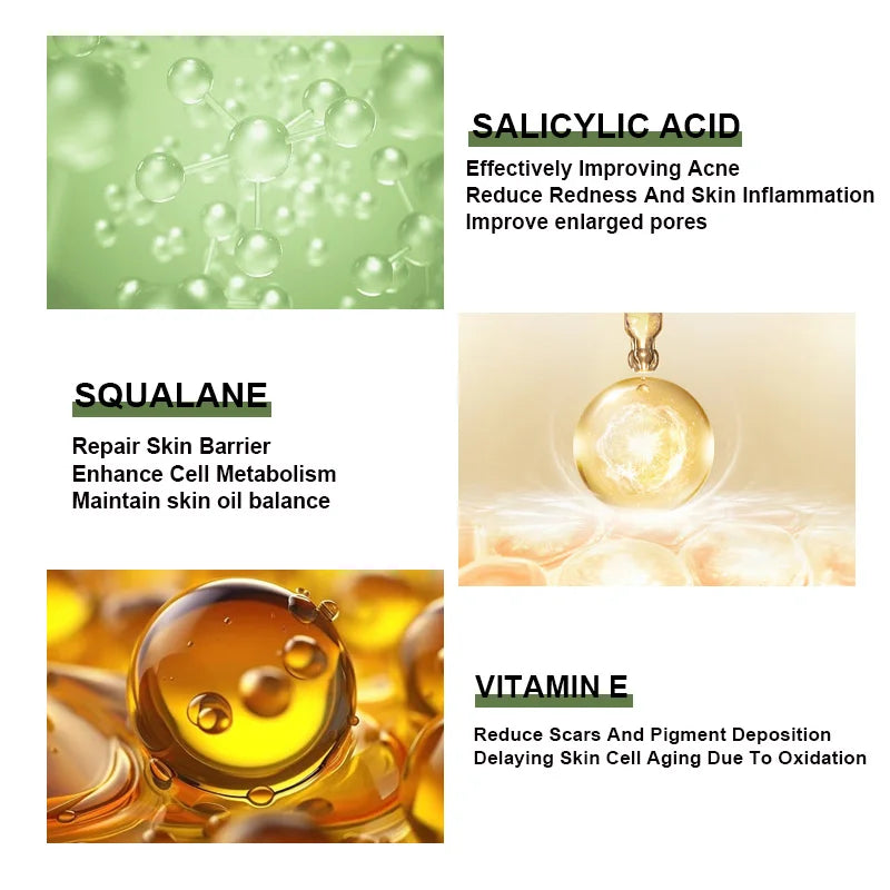 Anti-Acne Face Serum  Korean Skincare Products