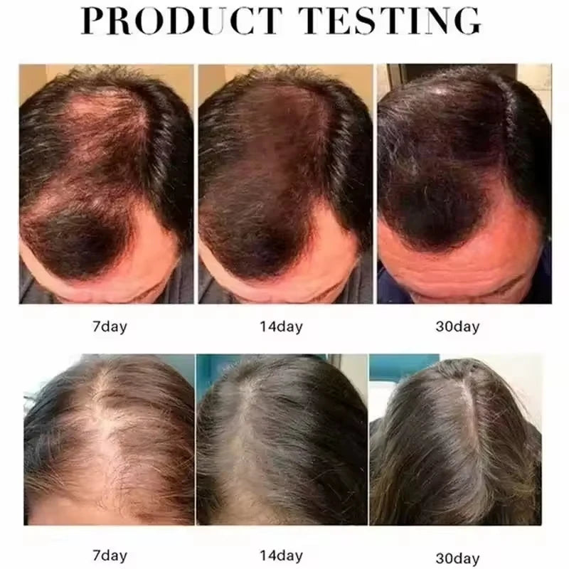 Fast Hair Growth Serum Men