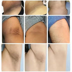 Brightening Cream For Body Knees Remove Dull Pigments Elbows Knuckles Lightening