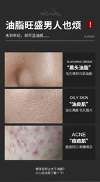 Oil Control Moisturizing Facial Cleanser