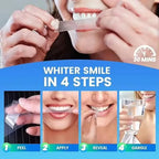 Purple Whitening Teeth Stickers 14 Pairs