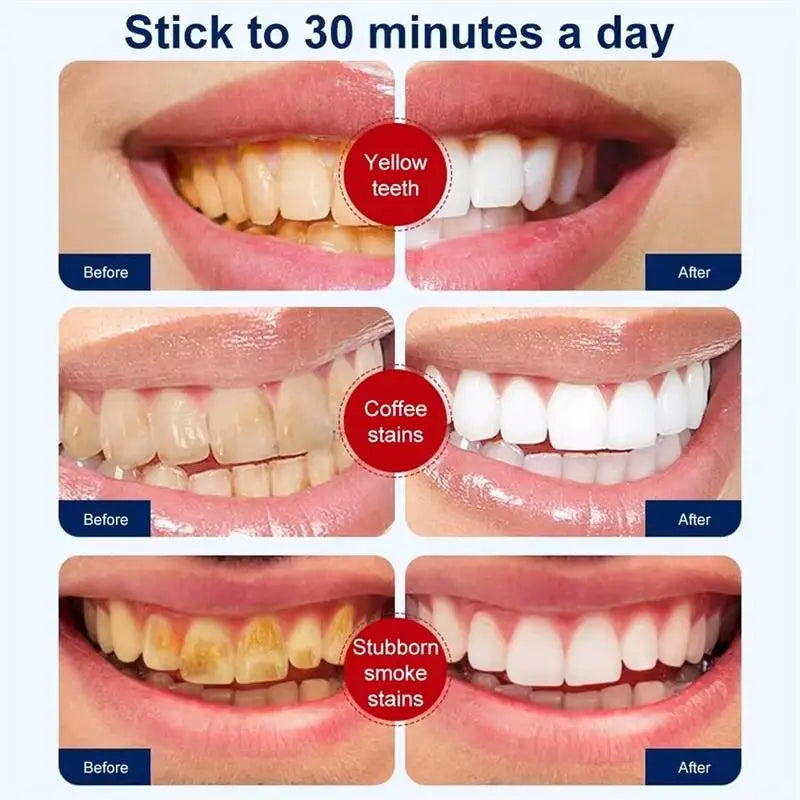 Purple Whitening Teeth Stickers 14 Pairs