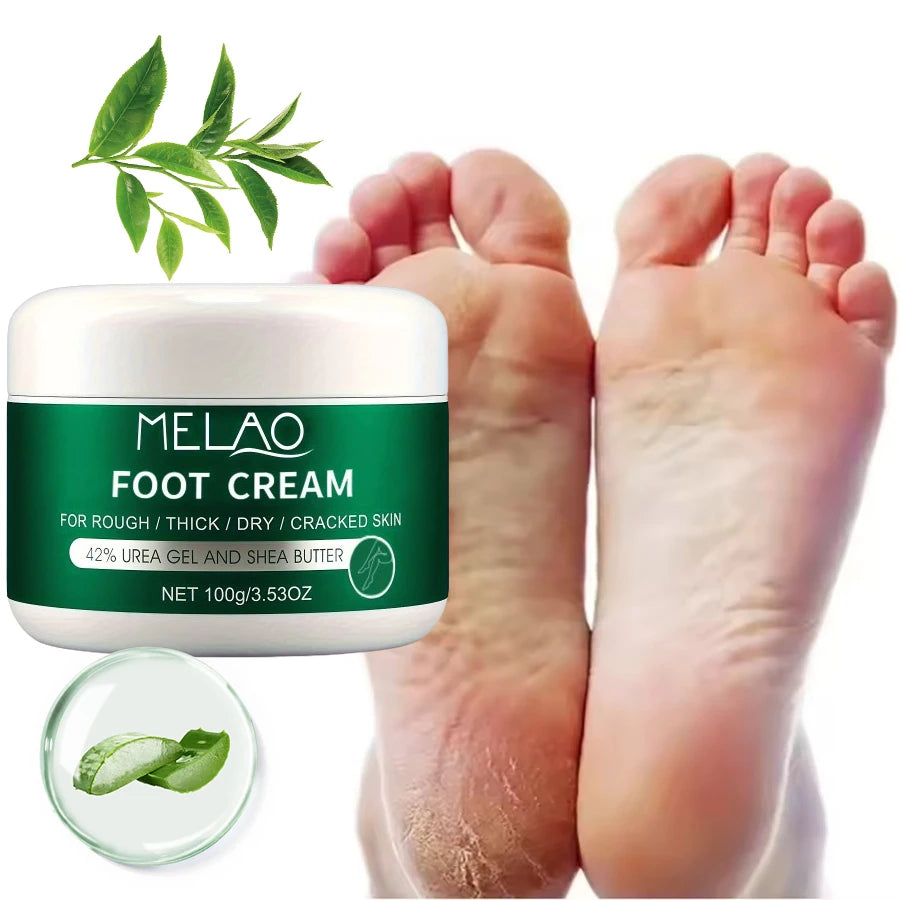 MELAO Urea Cream Salicylic Acid Dry Cracked Feet Heels Dead Skin Remover