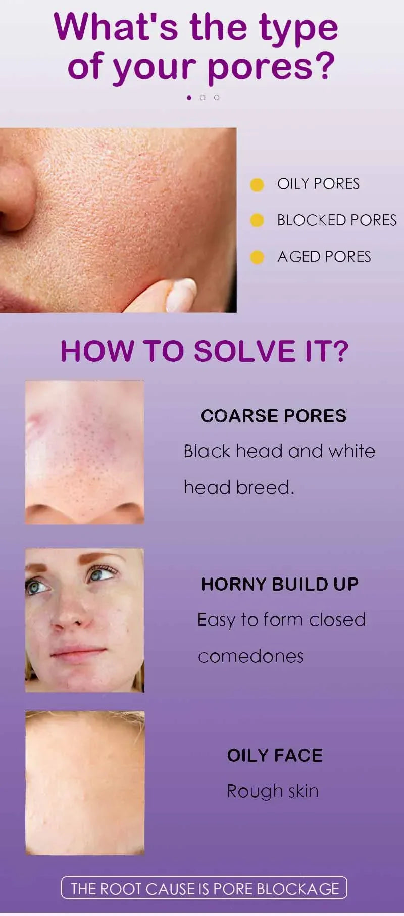 Skin Texture Pore Refining Resurfacing Brightening Facial Serum Retinol and Niacinamide Non-Comedogenic