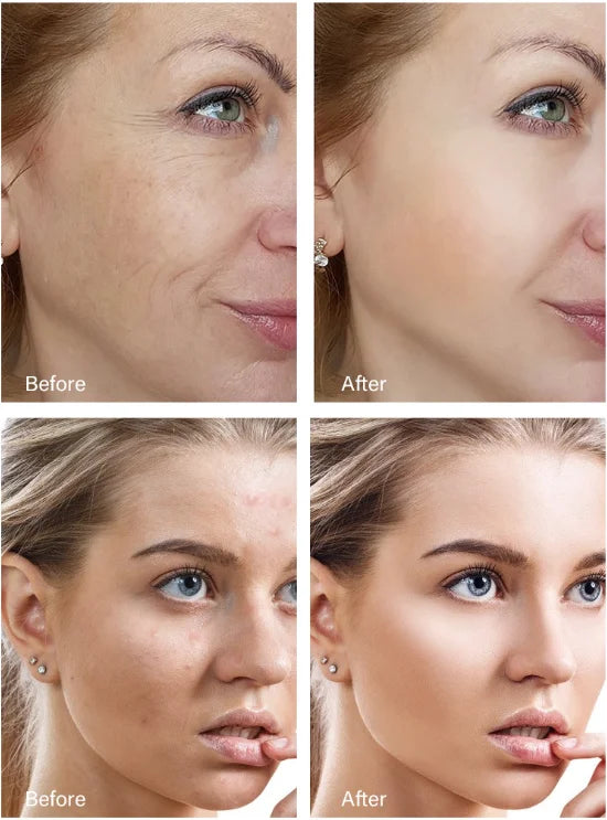 Retinol Wrinkle Remover Face Cream Firming Lifting Anti Aging Fade Fine Lines Moisturizing Whitening Korean