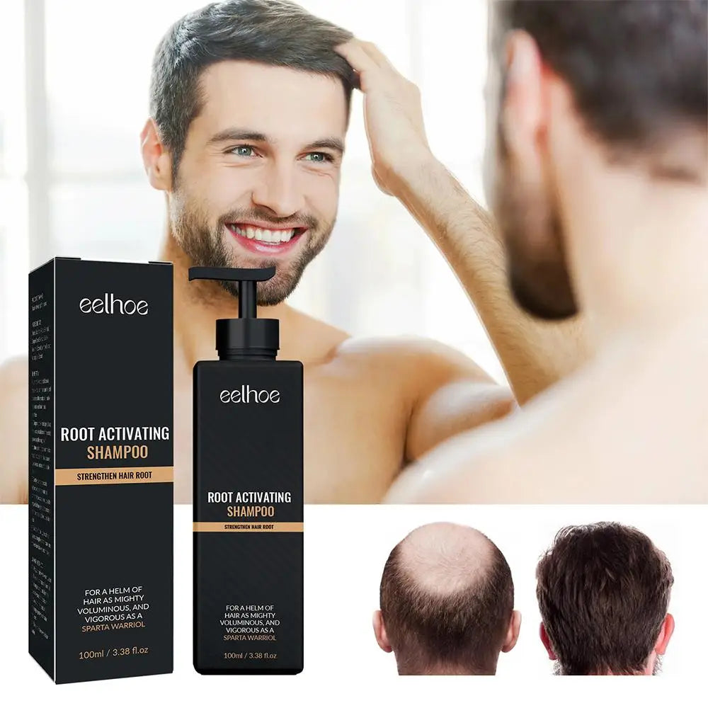 Anti Baldness Shampoo Thickening Root Activator Nourish Regrowth for Thinning Hair & Hair Loss