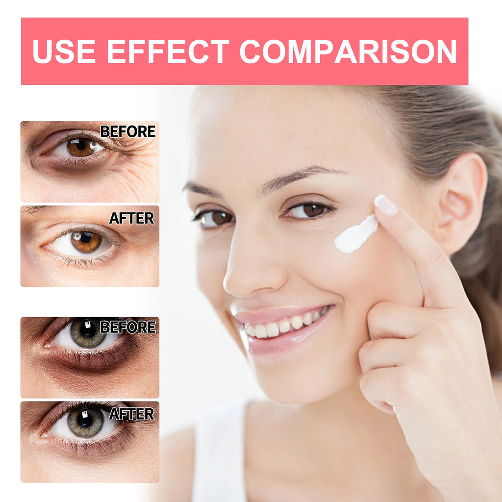 Retinol Eye Cream Stick Dark Circles Anti-Puffiness Smooth Brightening Moisturizing Firming Under Eye Treatment