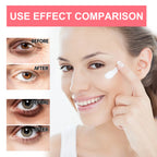 Retinol Eye Cream Stick Dark Circles Anti-Puffiness Smooth Brightening Moisturizing Firming Under Eye Treatment