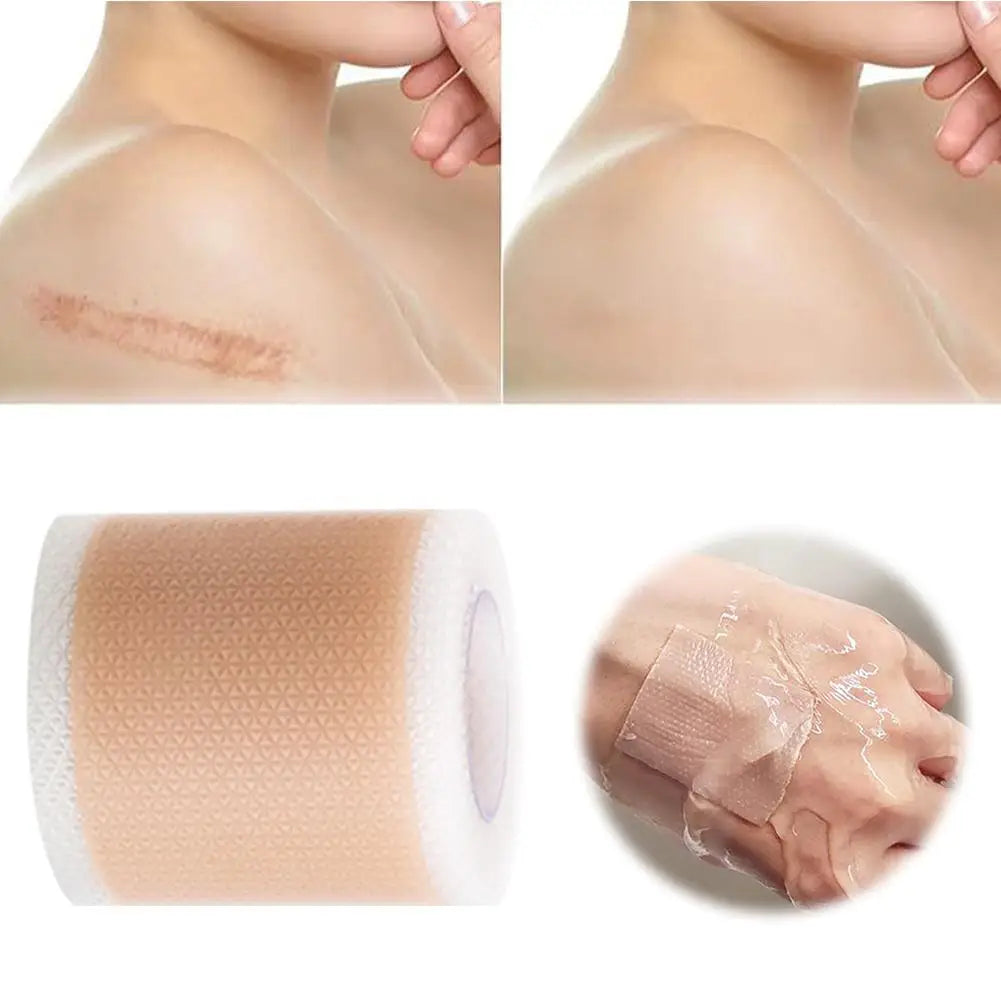 4X300CM Silicone Scar Patch Skin Repair Sheets Self-Adhesive Stretch Mark Tape Therapy Patch Burn Acne Scar  ﻿
