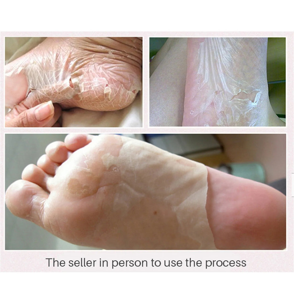 Exfoliating Foot Peel Mask